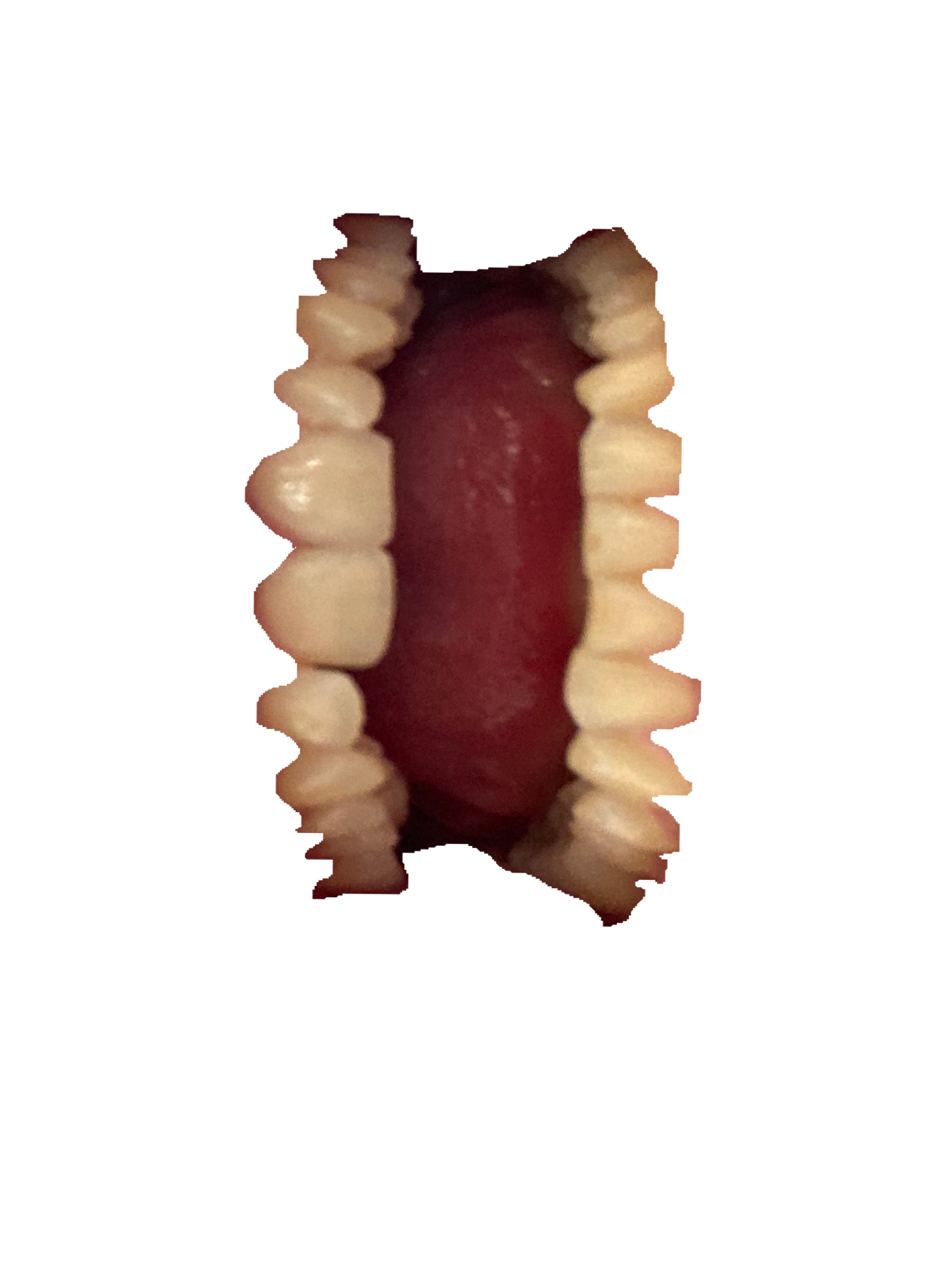 Dent